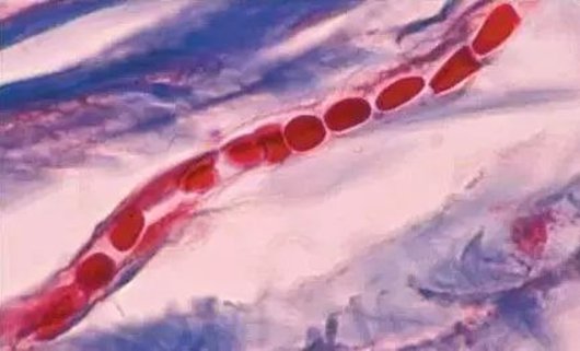 為什么久坐久站腳會發麻