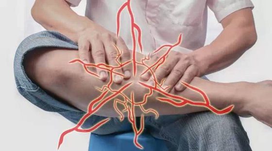 為什么蹲久了腿會麻,腿麻是怎么回事