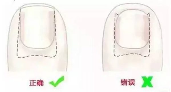 為什么剪指甲不會疼,剪指甲不疼是怎么回事