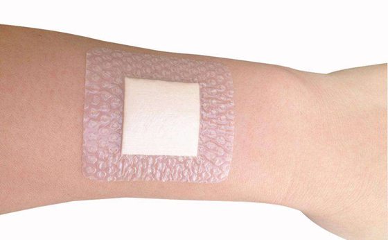 為什么傷口愈合時會感覺癢,傷口愈合特別癢怎么辦