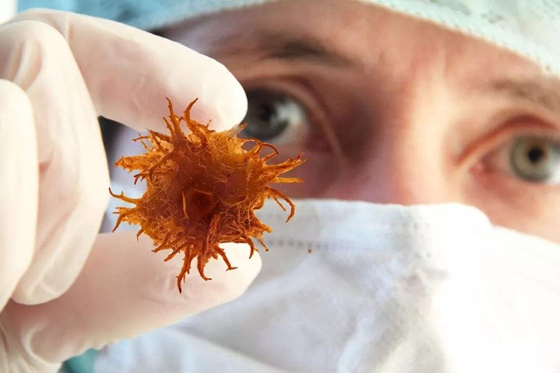 為什么癌癥治不好,為何癌癥不能治愈