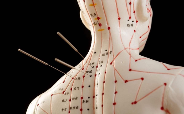 針灸為什么能治病,針灸治病的原理是什么