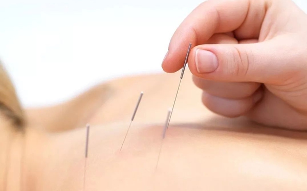 針灸為什么能治病,針灸治病的原理是什么